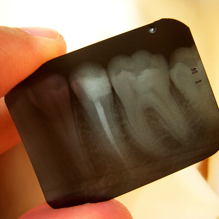 See The Full Picture…On Dental X-Rays