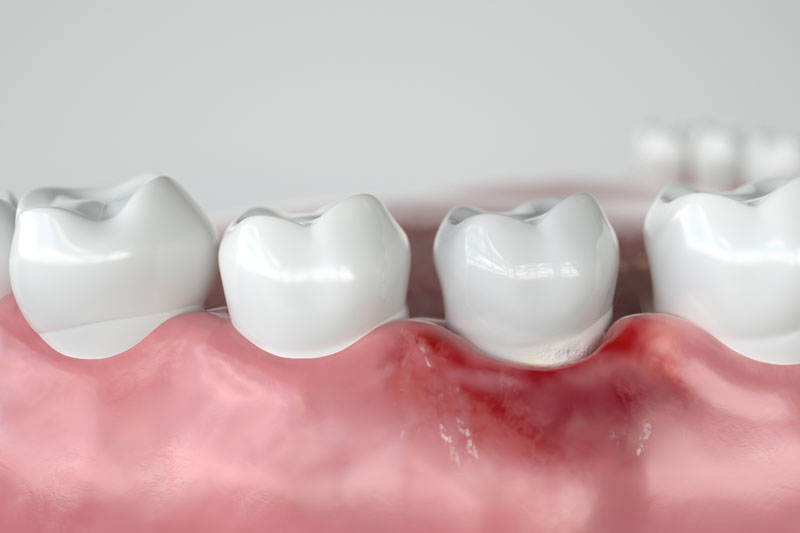 Discover the Art of Healthy Smiles with a Dentist in Missoula MT
